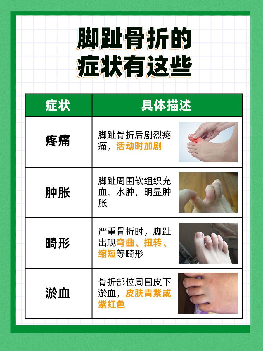 脚趾骨折的症状有哪些?一文了解