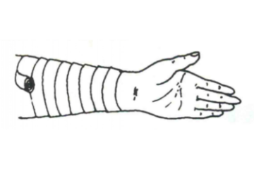 螺旋形包扎法图 螺旋形包扎法图