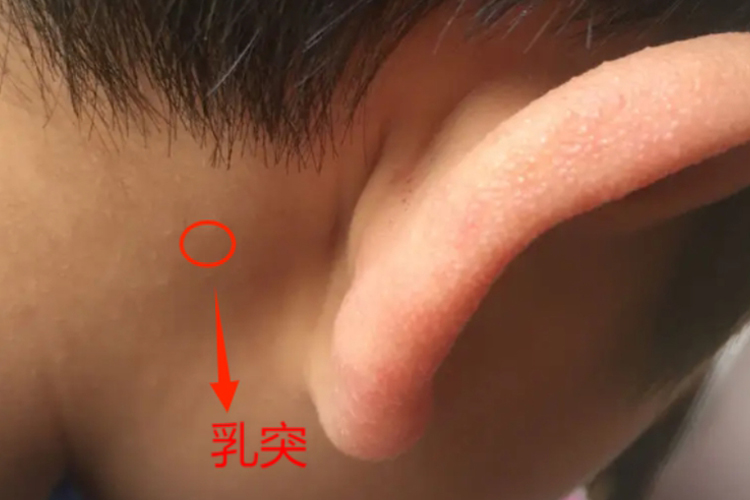 小孩乳突骨正常图