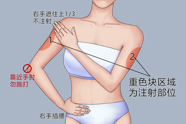 胰岛素注射手臂位置图