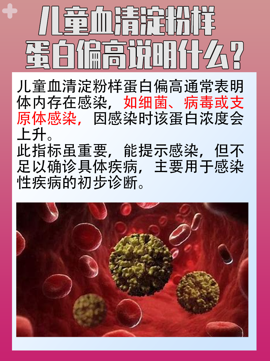 儿童血清淀粉样蛋白偏高说明什么？专家解答