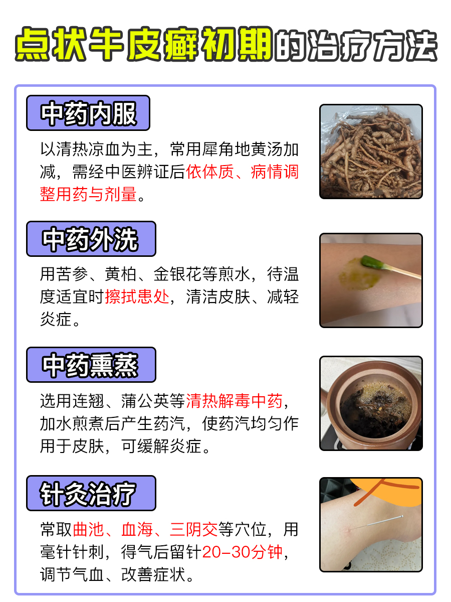 点状牛皮癣初期模样,速来围观!