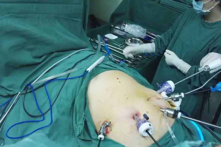 确定穿刺口位置图