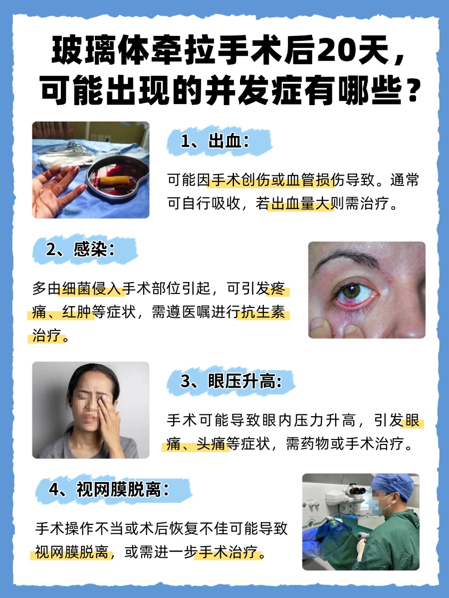 玻璃体牵拉手术后20天，这些注意事项你做到了吗？