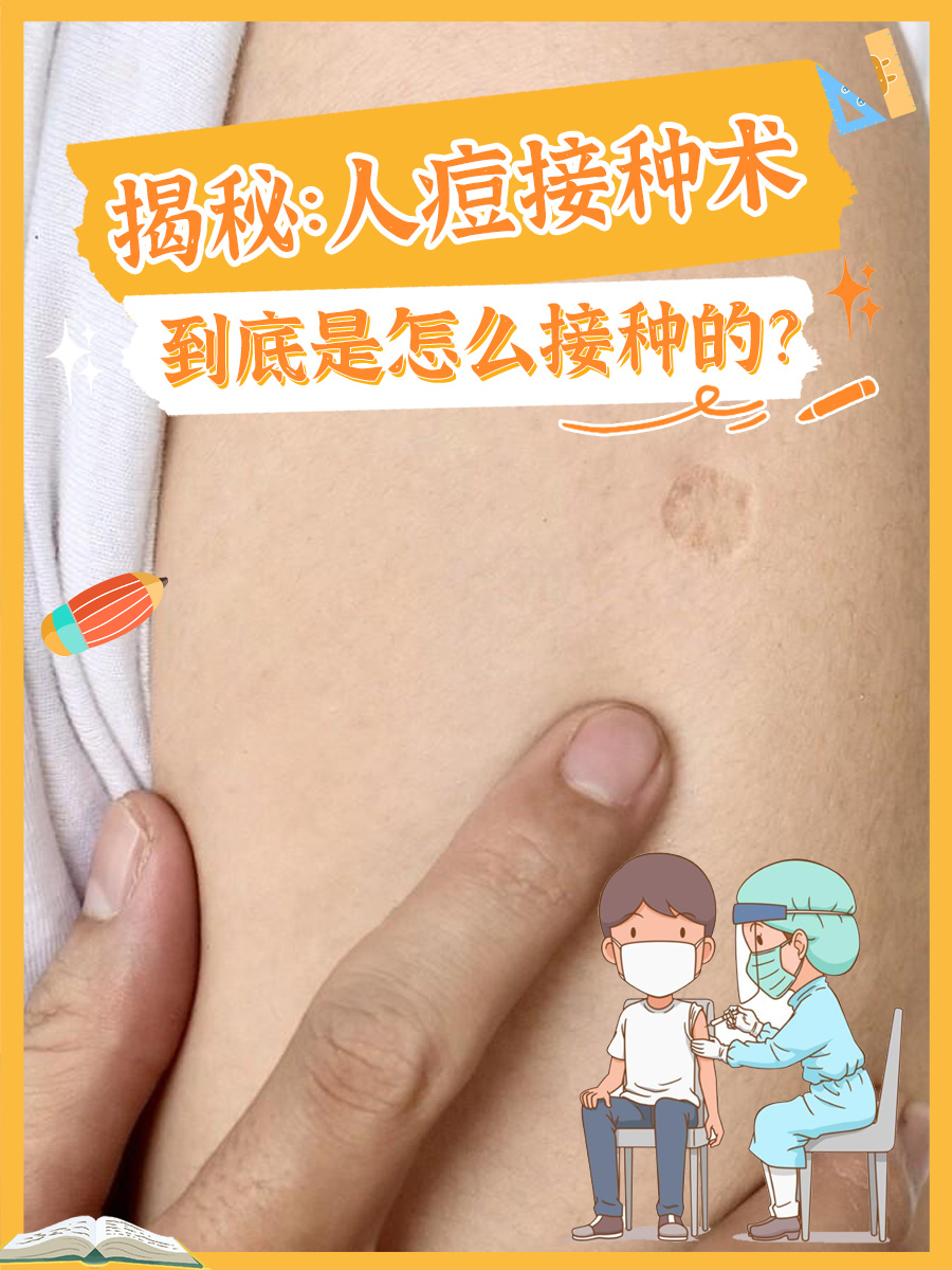 揭秘：人痘接种术到底是怎么接种的？
