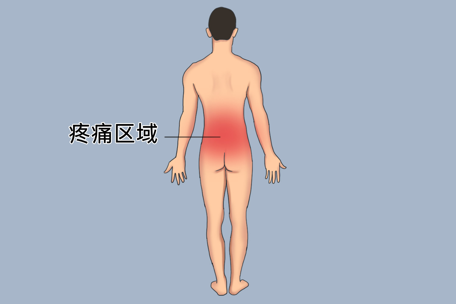 腰肌劳损腰上面疼痛位置图