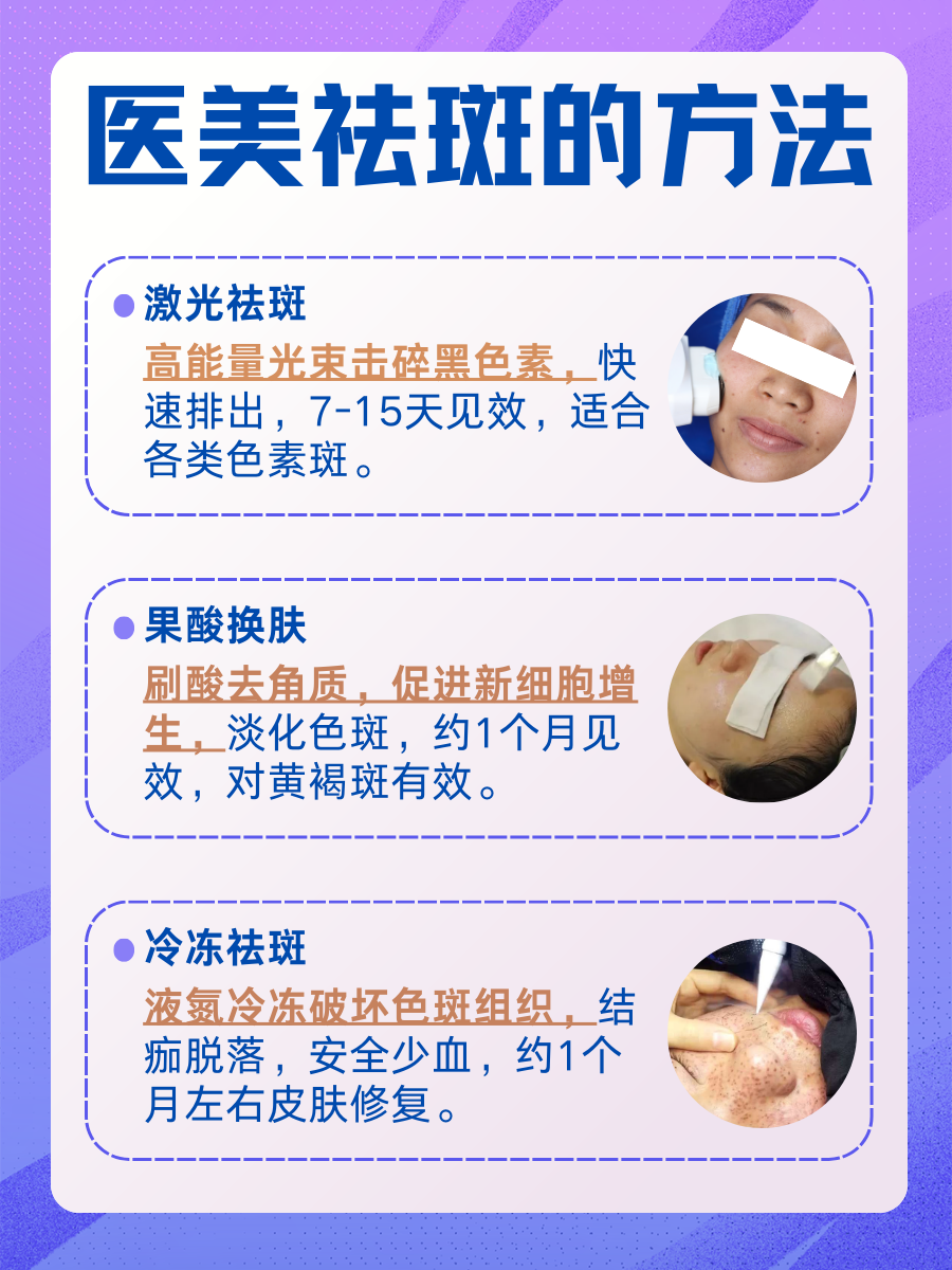 医美祛斑，这几招比较实用