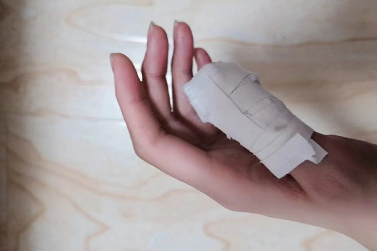 大拇指包扎图 大拇指包扎图