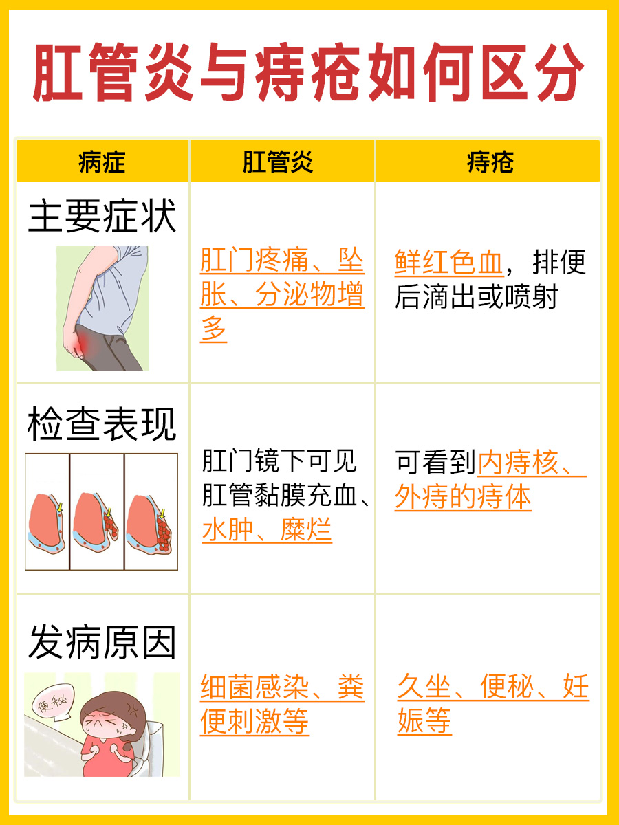 肛管炎来袭,这些症状你中招了吗?