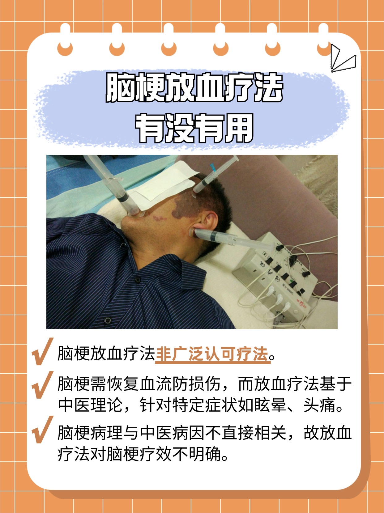 脑梗放血疗法有没有用？看这里