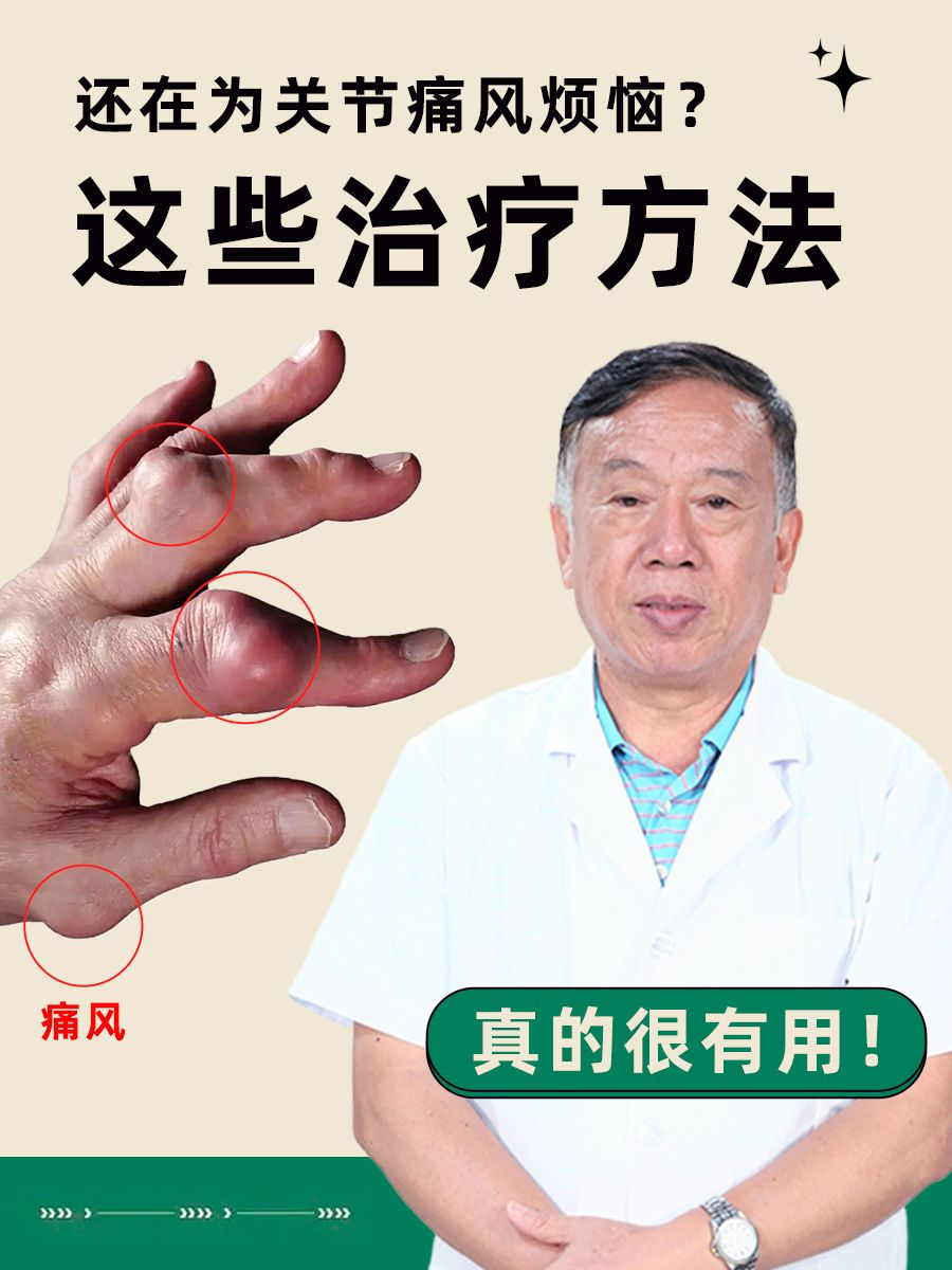 还在为关节痛风烦恼？这些治疗方法真的很有用！
