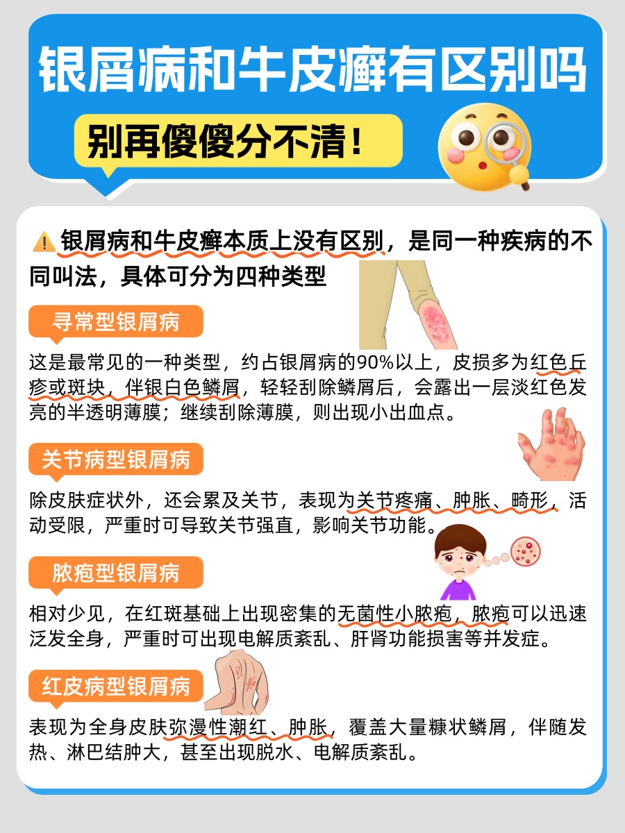 银屑病和牛皮癣有区别吗，别再傻傻分不清！