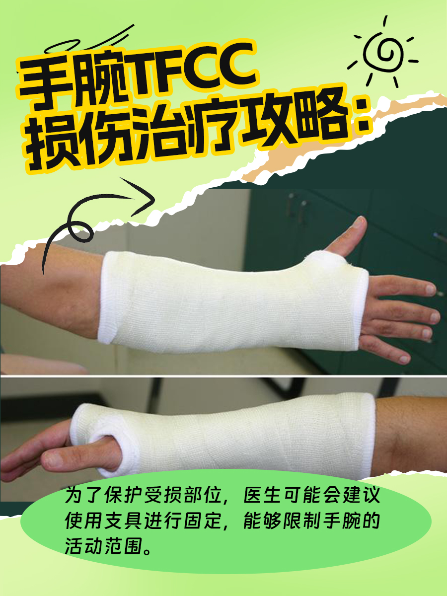 手腕TFCC损伤治疗攻略:告别疼痛困扰!