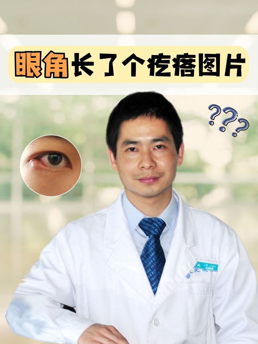 眼角长了个疙瘩图片