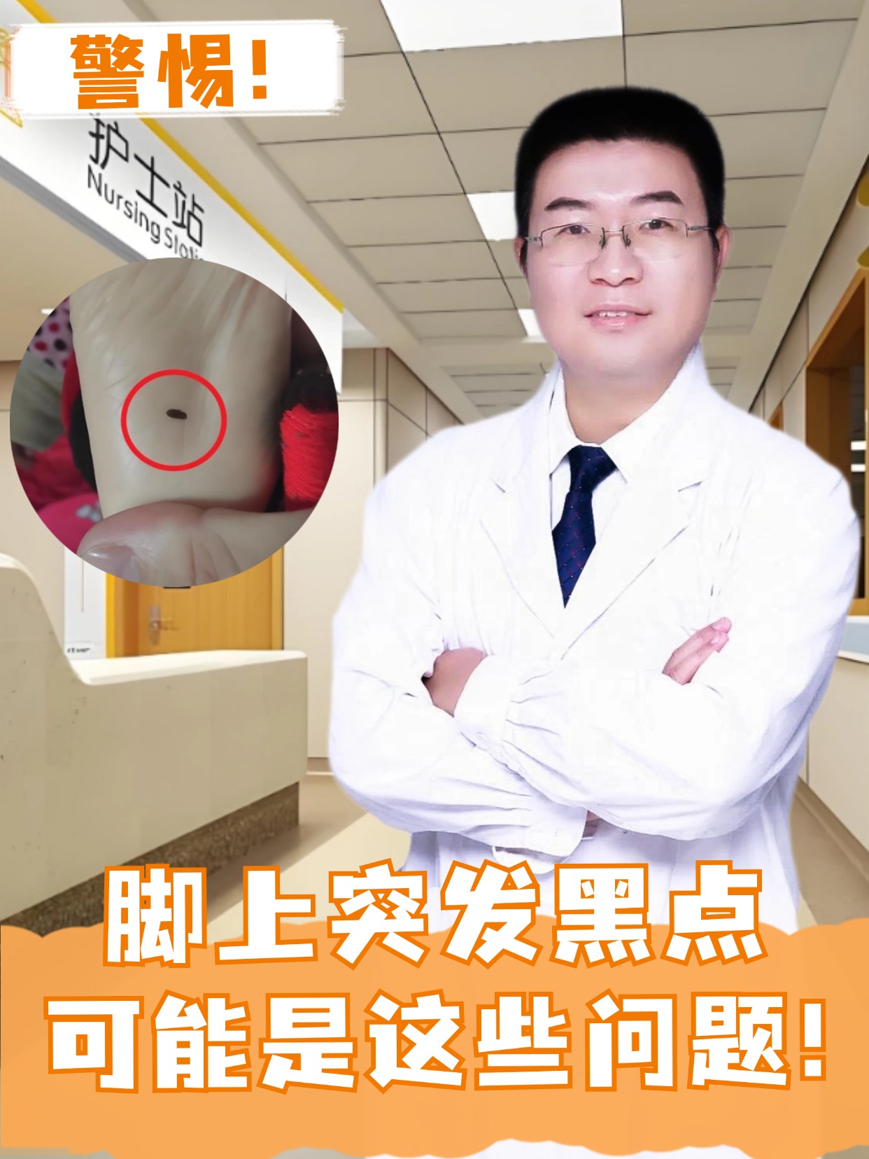 警惕！脚上突发黑点，可能是这些问题！