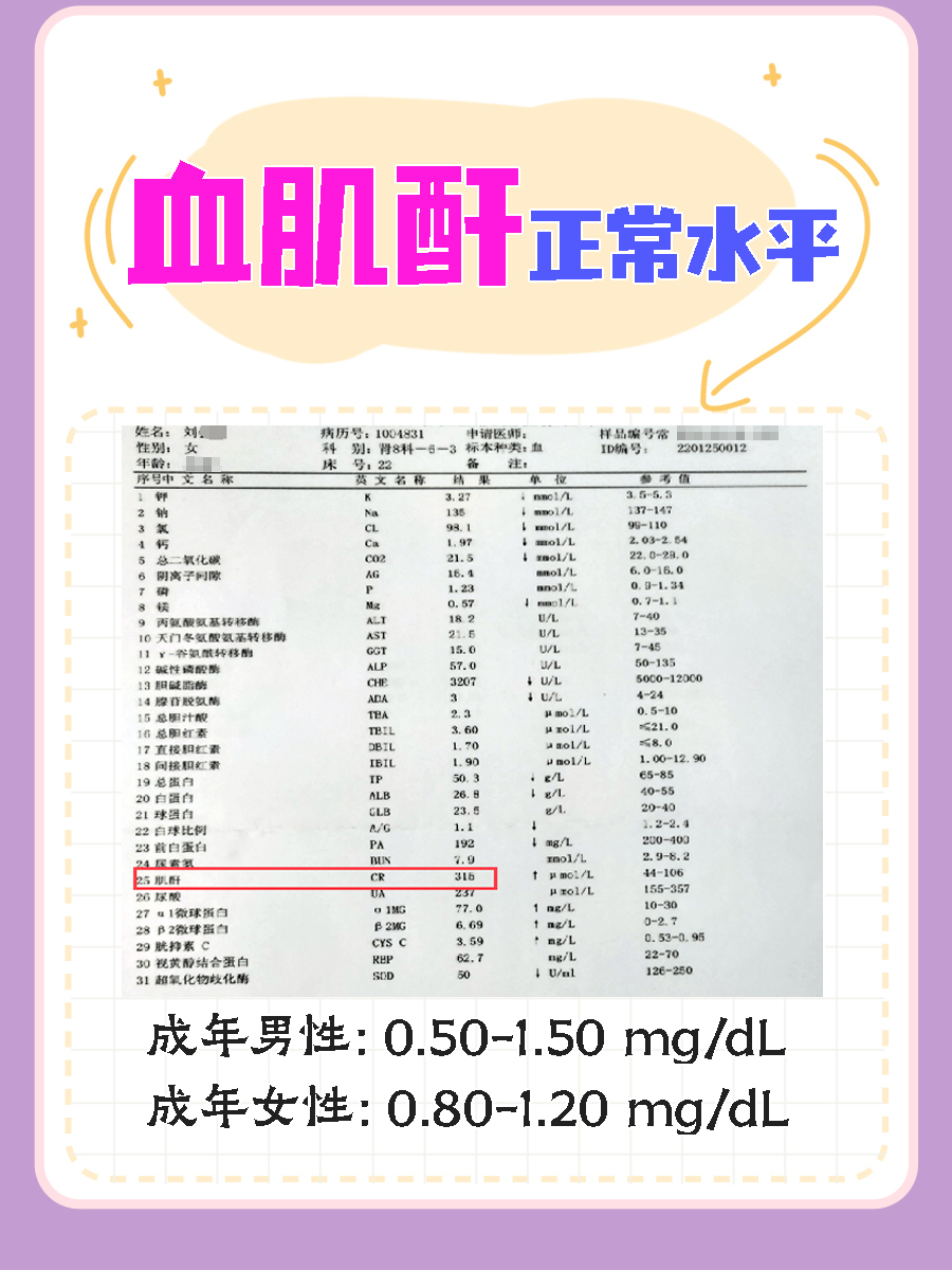 分享：肌酐高是什么问题，你知道吗？