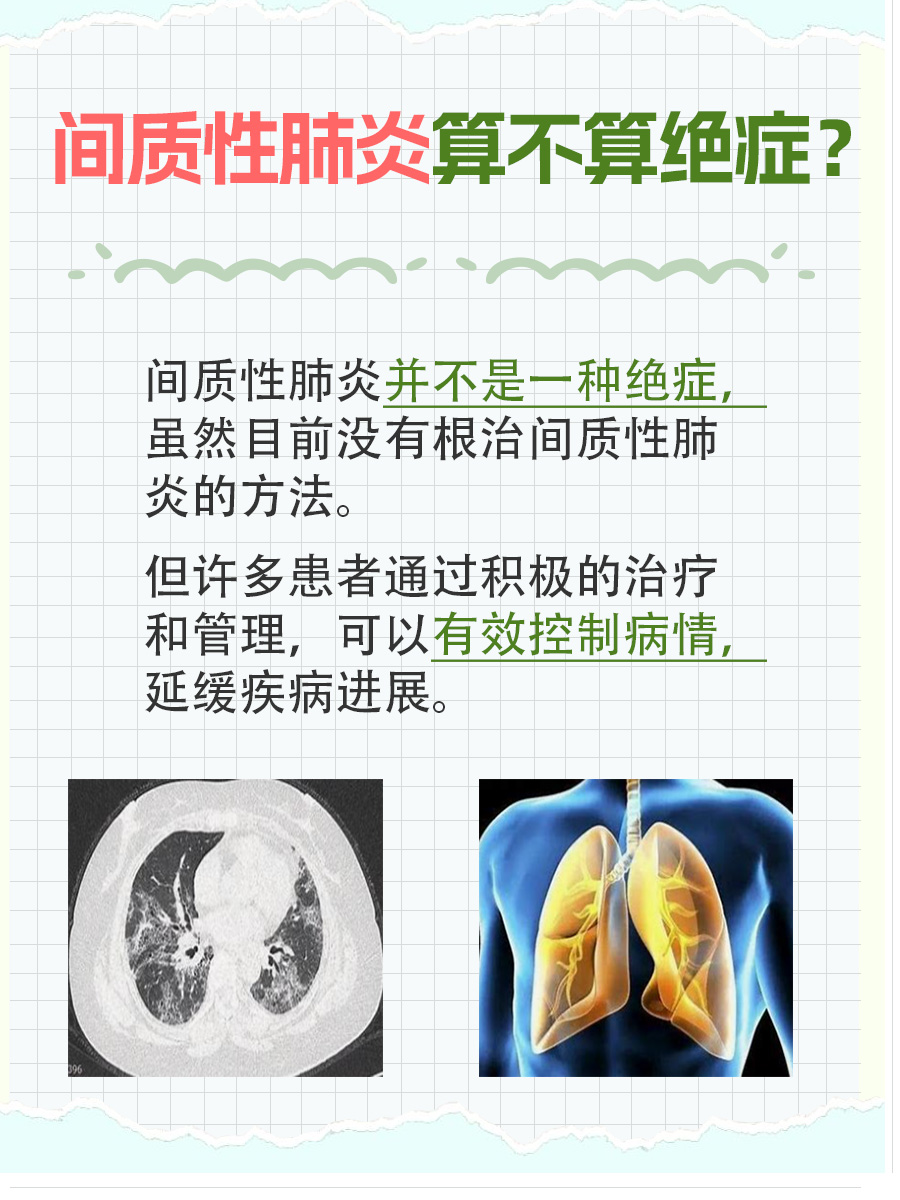 揭开真相：间质性肺炎是否算绝症？