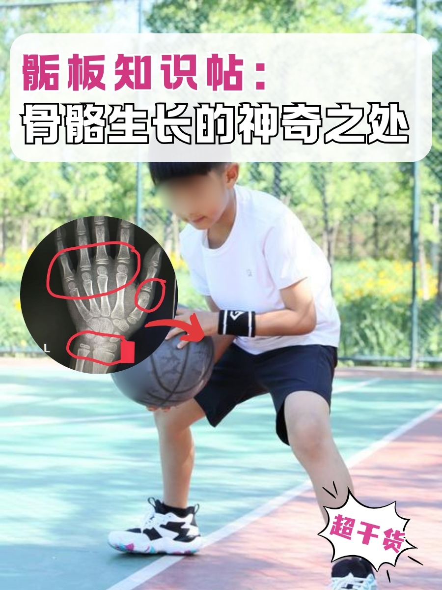 骺板知识帖:骨骼生长的神奇之处