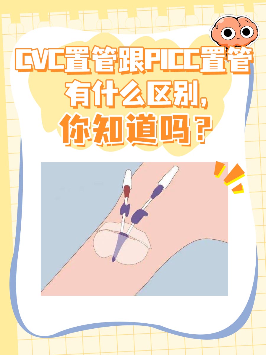 CVC置管跟PICC置管有什么区别，你知道吗？