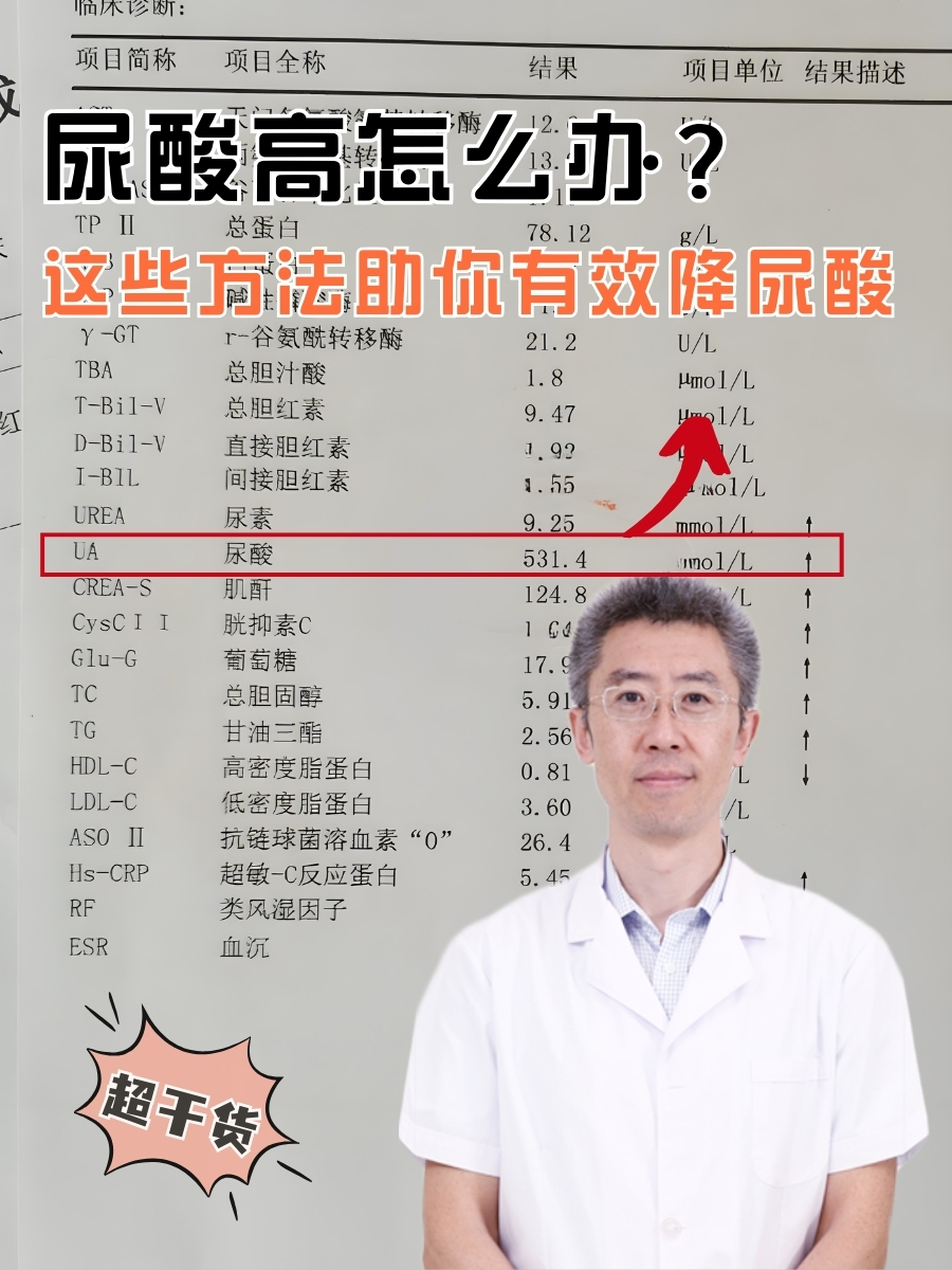 尿酸高怎么办？这些方法助你有效降尿酸