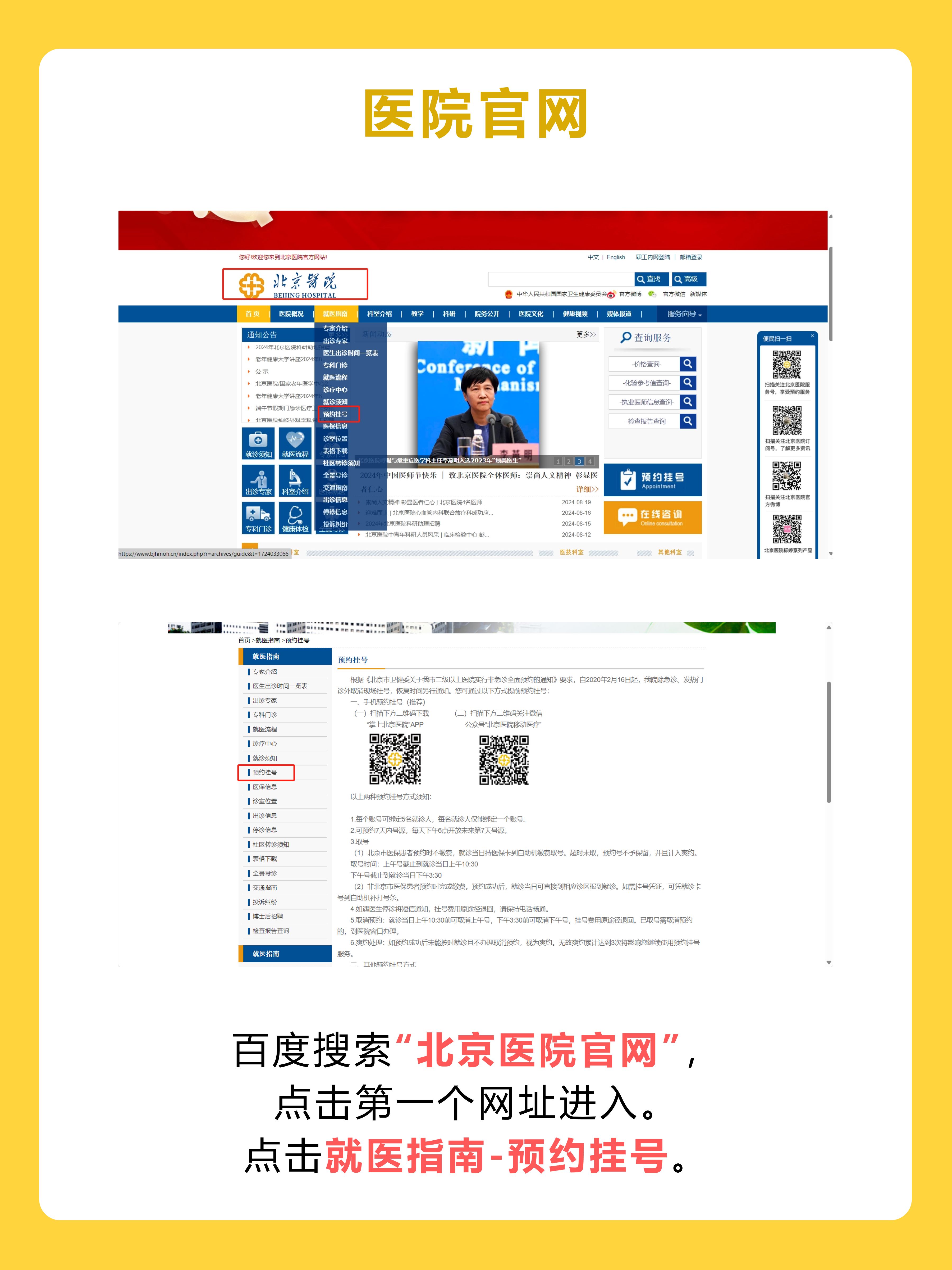 北京医院张华俦医生怎么样？怎么挂号？