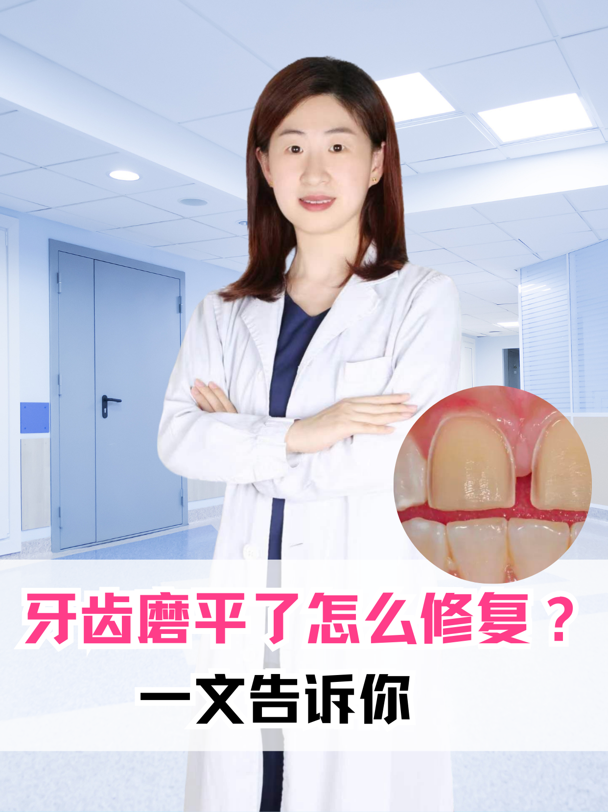 牙齿磨平了怎么修复？一文告诉你