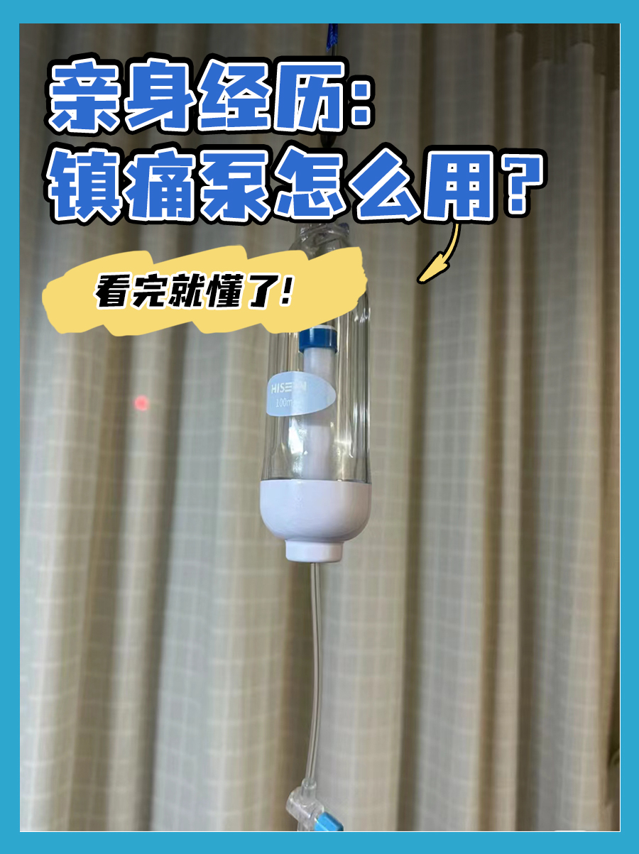 亲身经历：镇痛泵怎么用？看完就懂了！