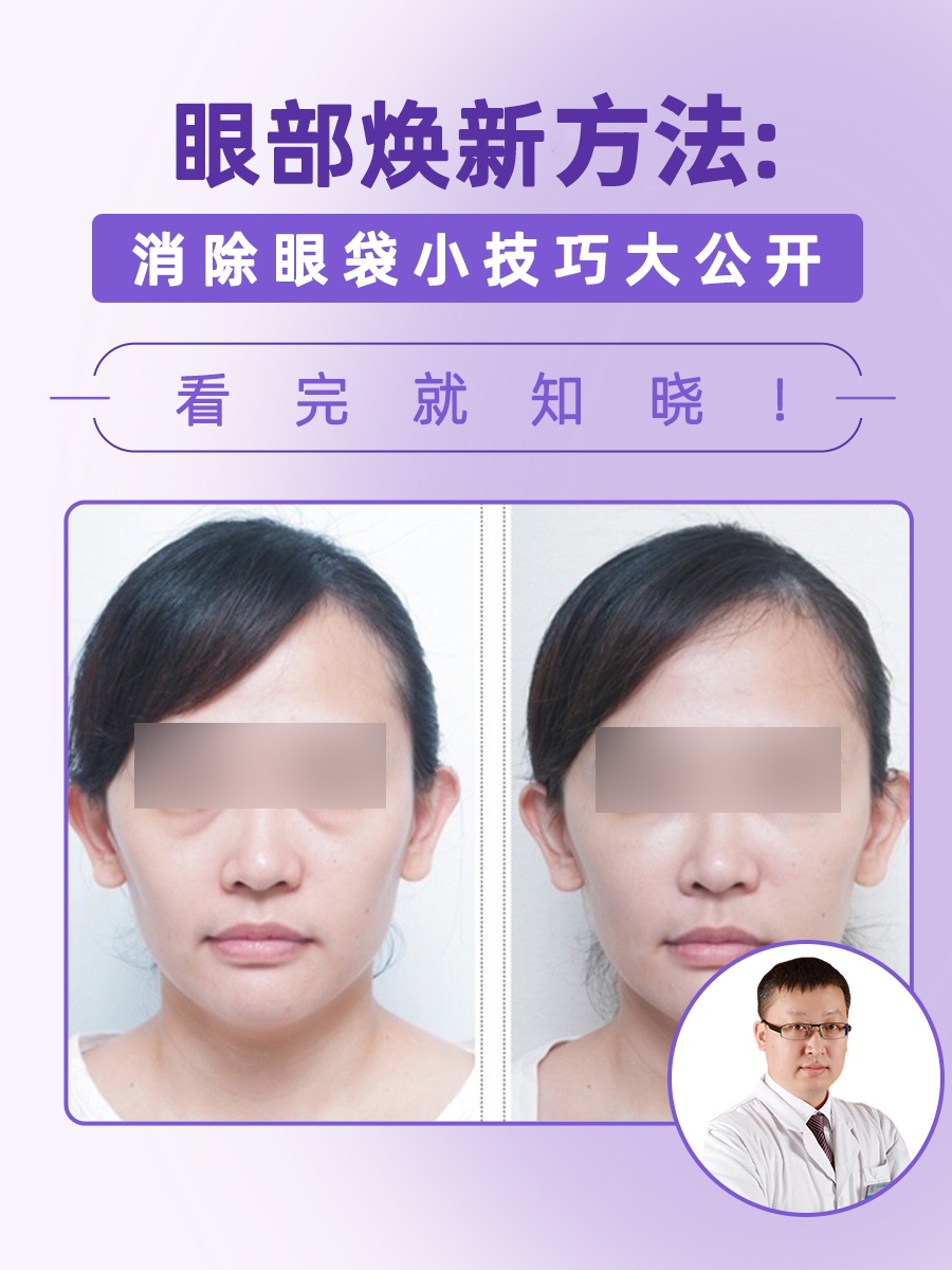 眼部焕新方法：消除眼袋小技巧大公开