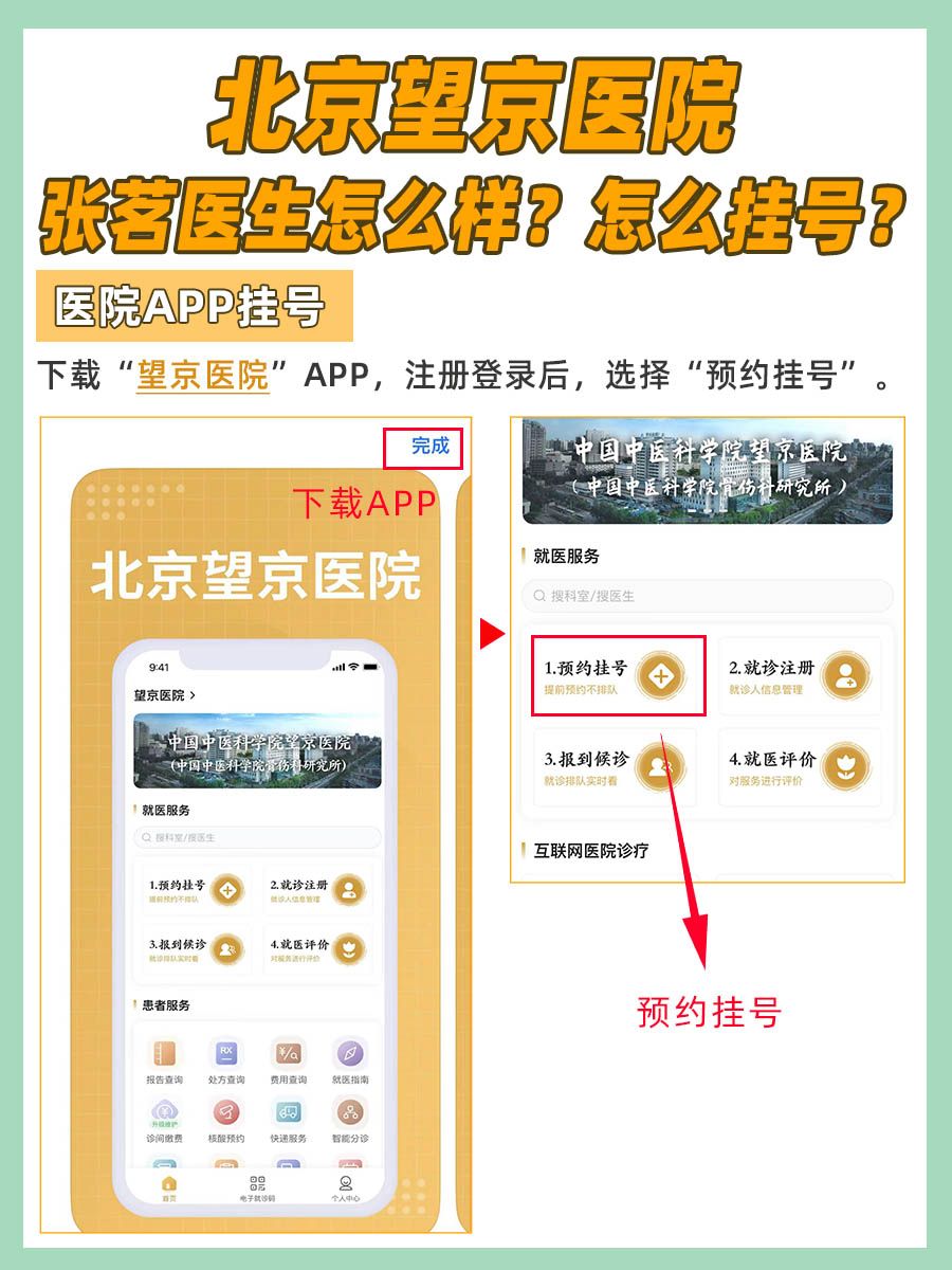 北京望京医院张茗医生怎么样?怎么挂号?
