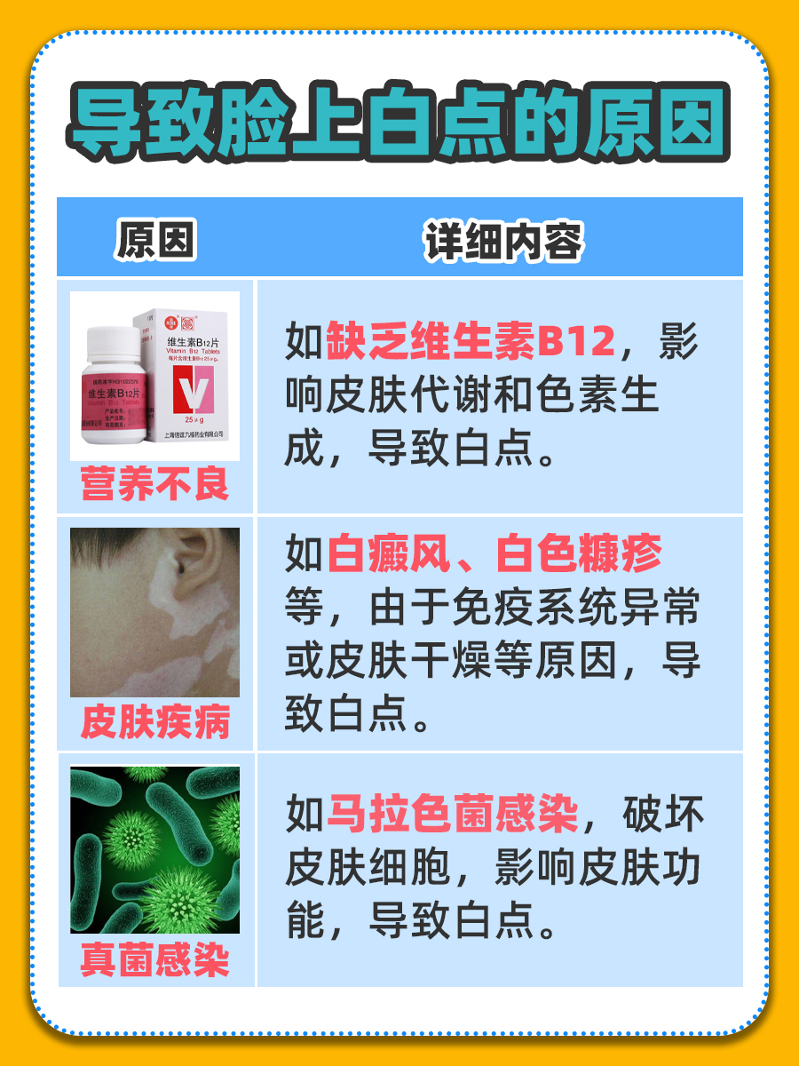 面部出现白点原因解析