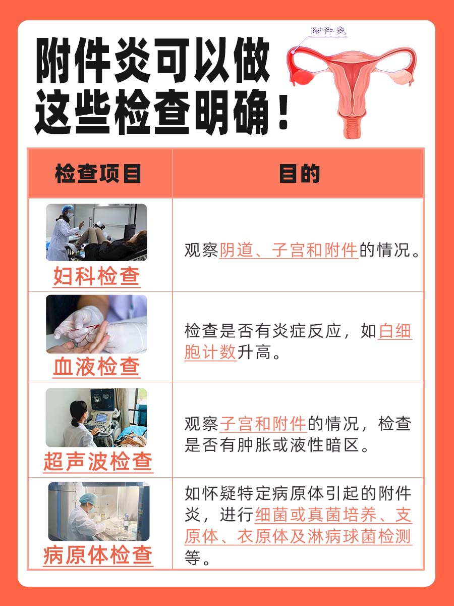 附件炎:做什么检查能查出来?