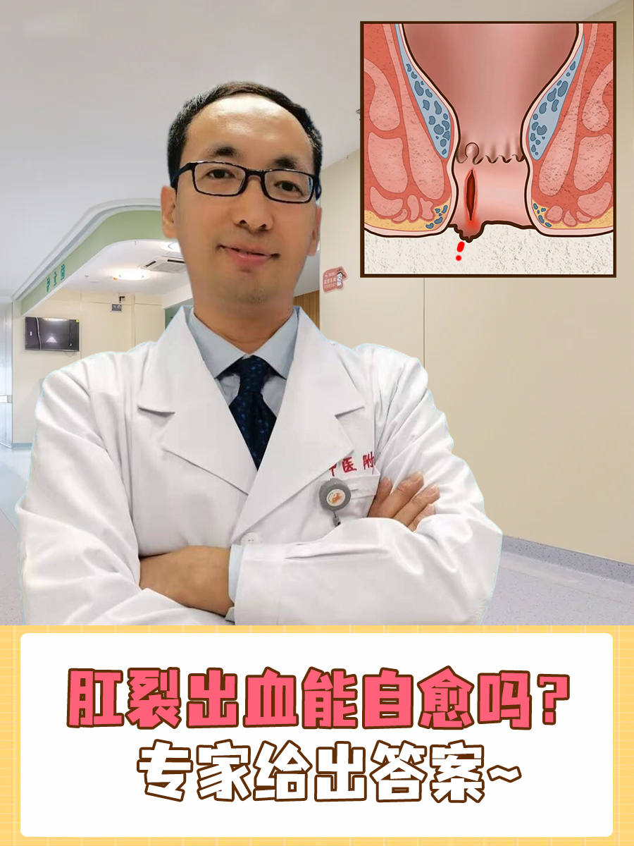 肛裂出血能自愈吗？专家给出答案~
