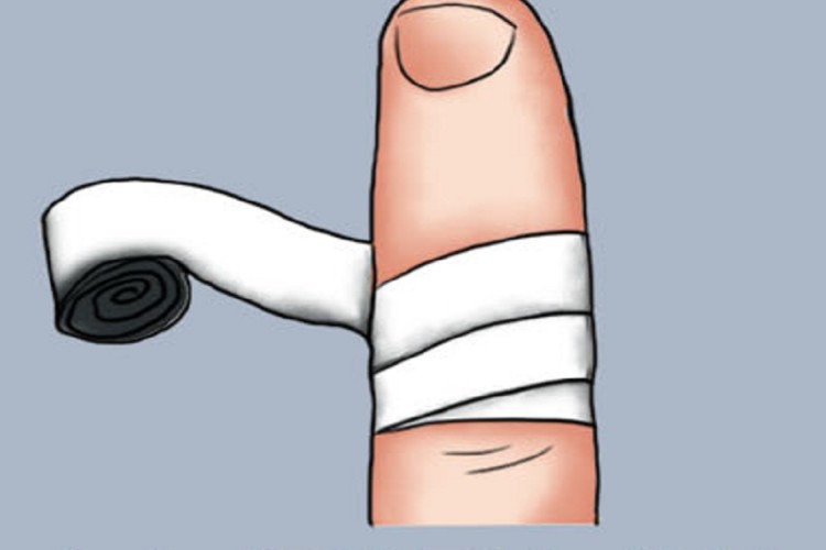 手指螺旋形包扎法图