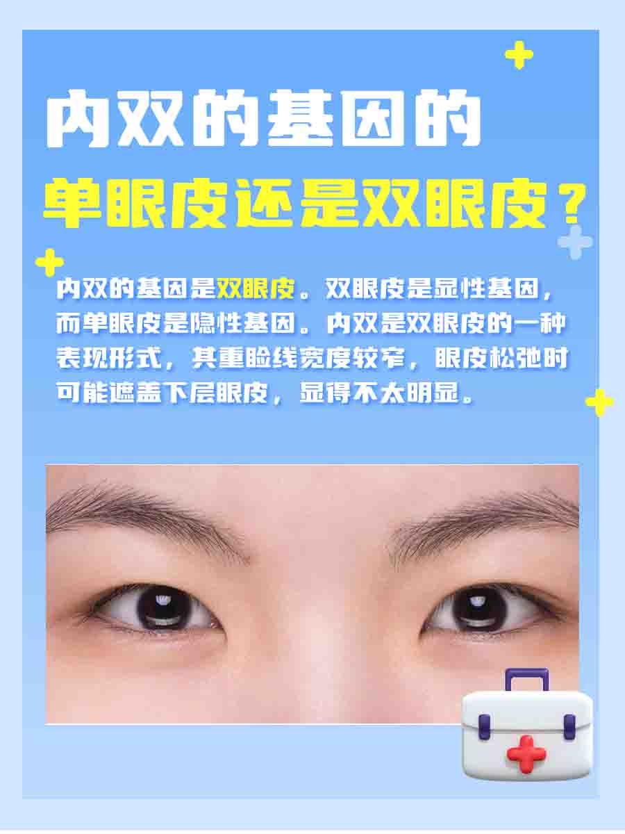 内双眼遗传密码：单眼皮还是双眼皮基因？