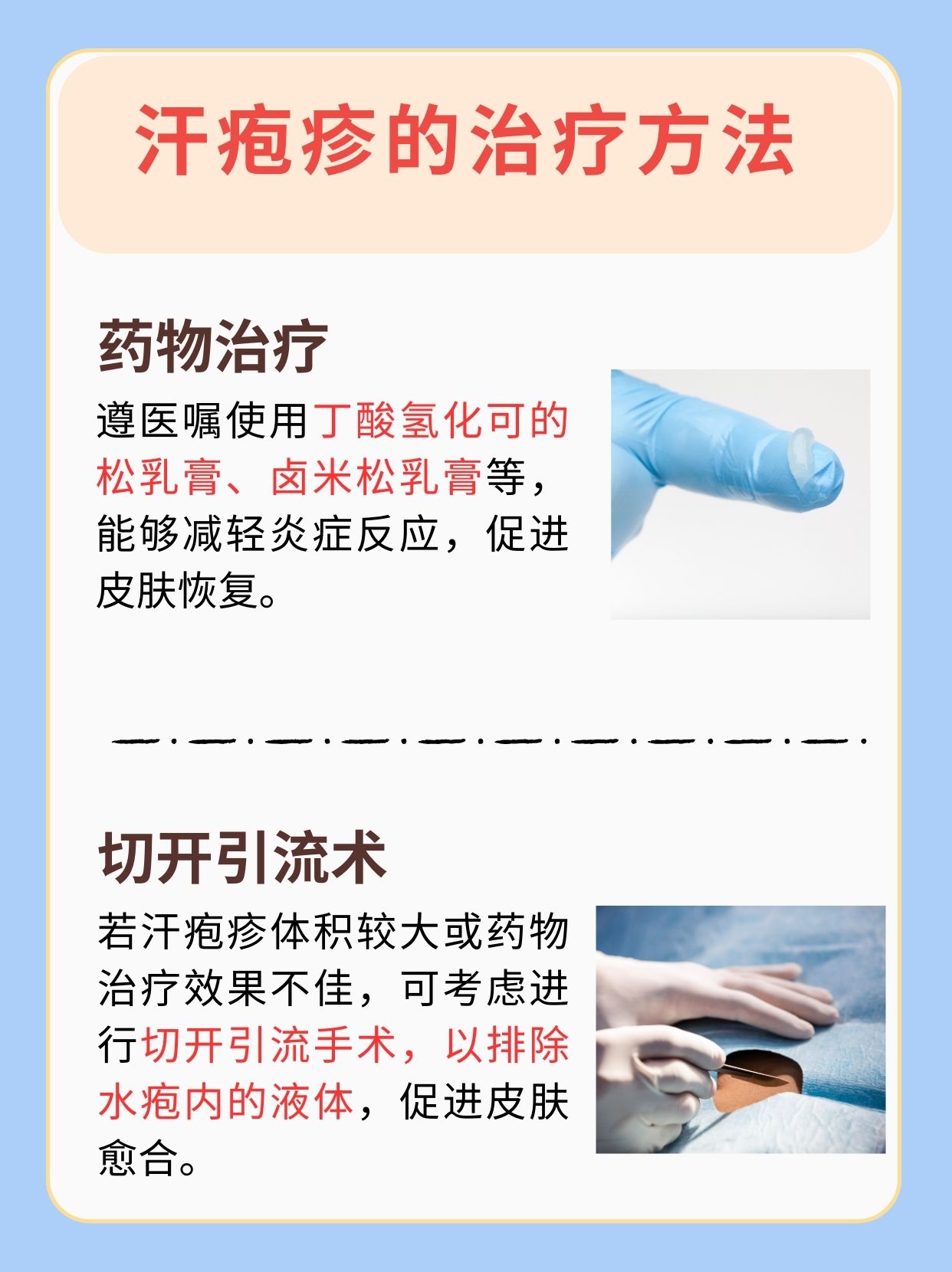 一文解析:汗疱疹抹藿香正气水全根治吗