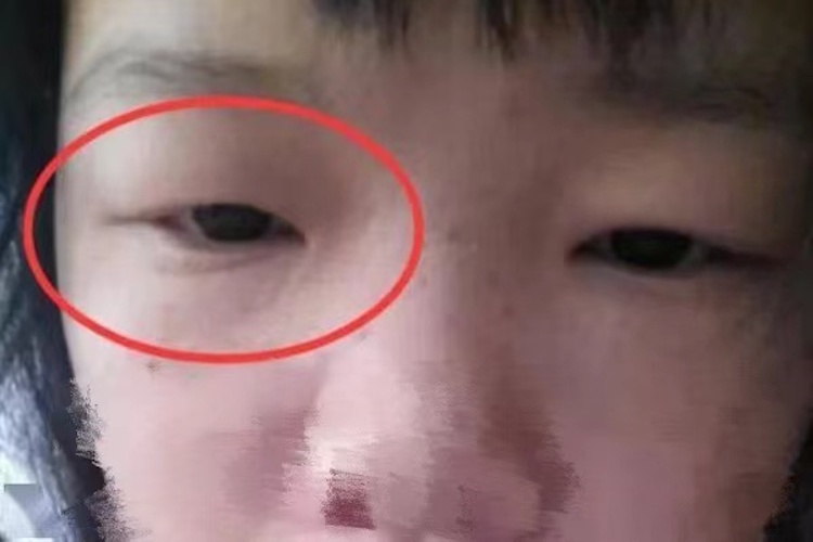 宝宝三角眼图 宝宝三角眼图