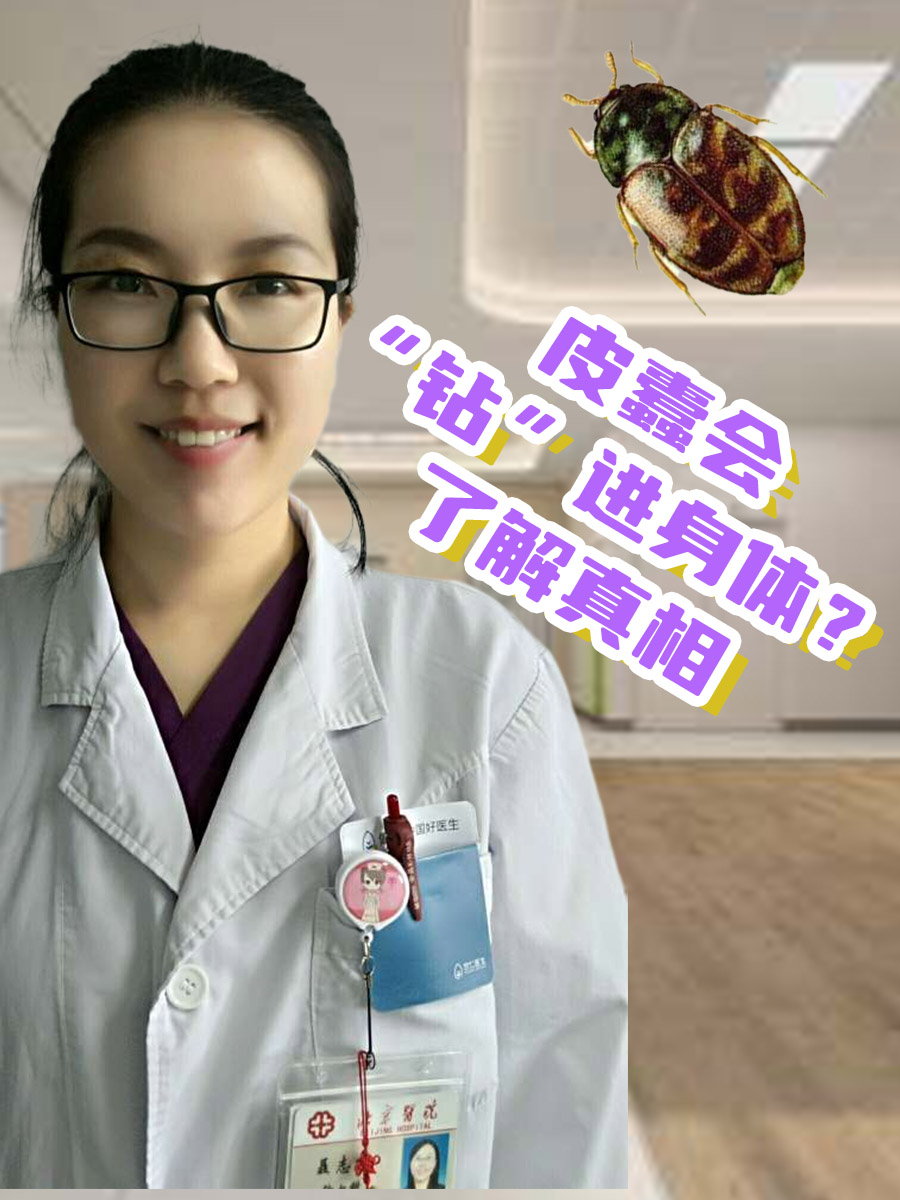 皮蠹会“钻”进身体?了解真相!