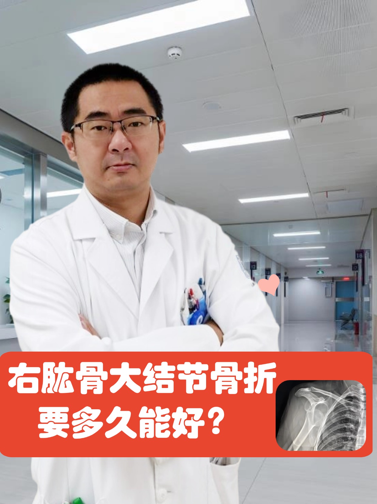 右肱骨大结节骨折，要多久能好？