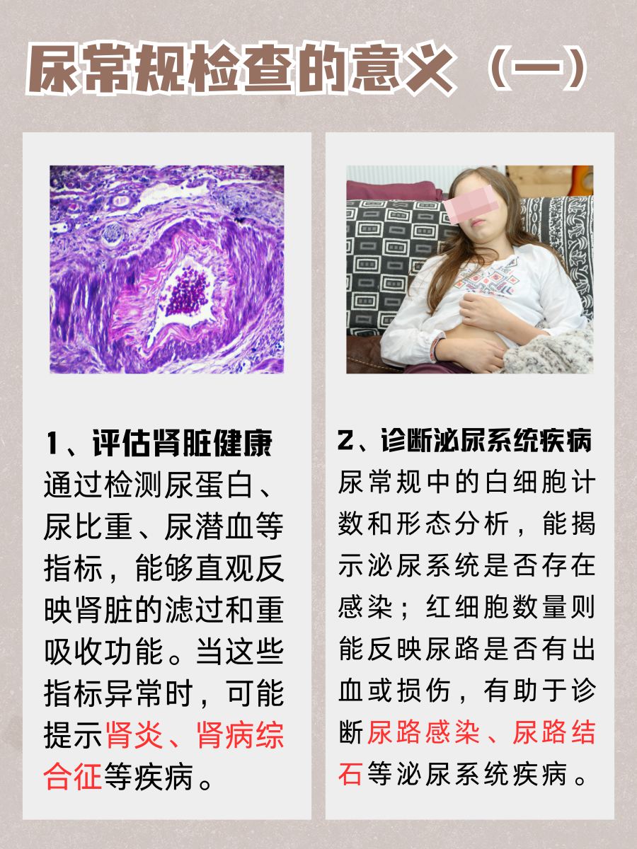 尿常规上午查VS下午查，结果大不同？