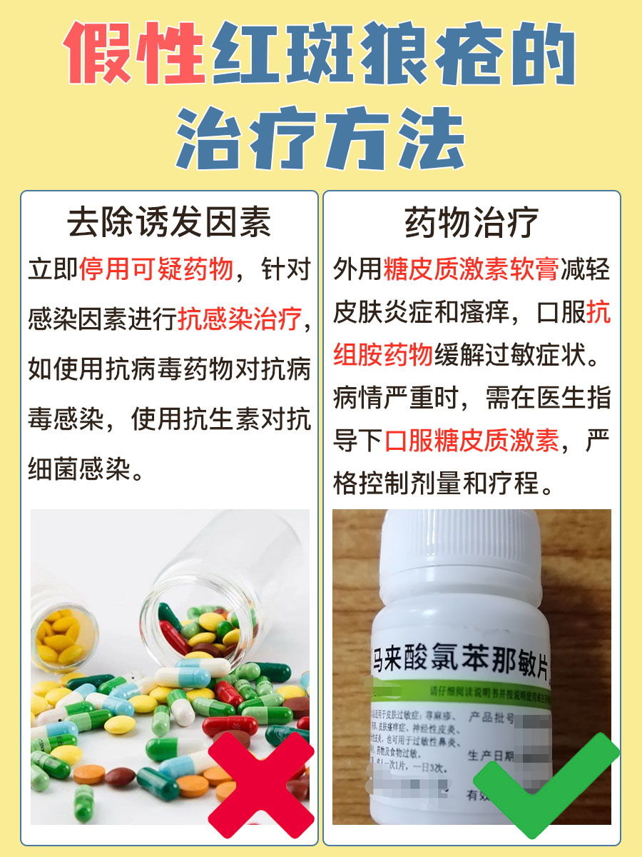 健康新知：假性红斑狼疮，背后原因一定要知道！