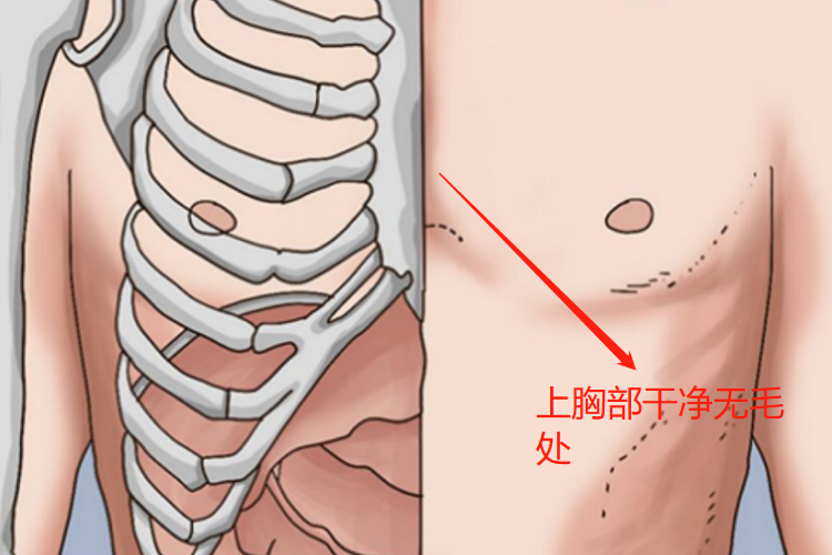 可乐定贴片贴于上胸部位置图