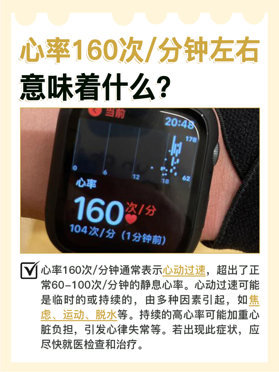 心率160次/分钟:究竟意味着什么?