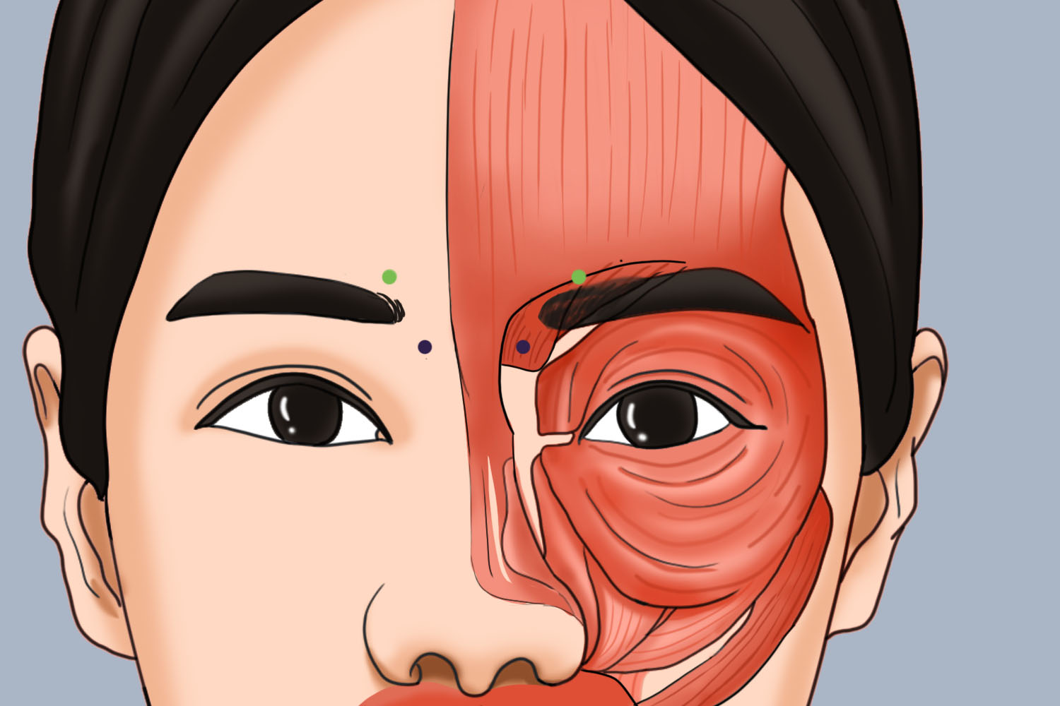 眉间注射点位图 眉间注射点位图