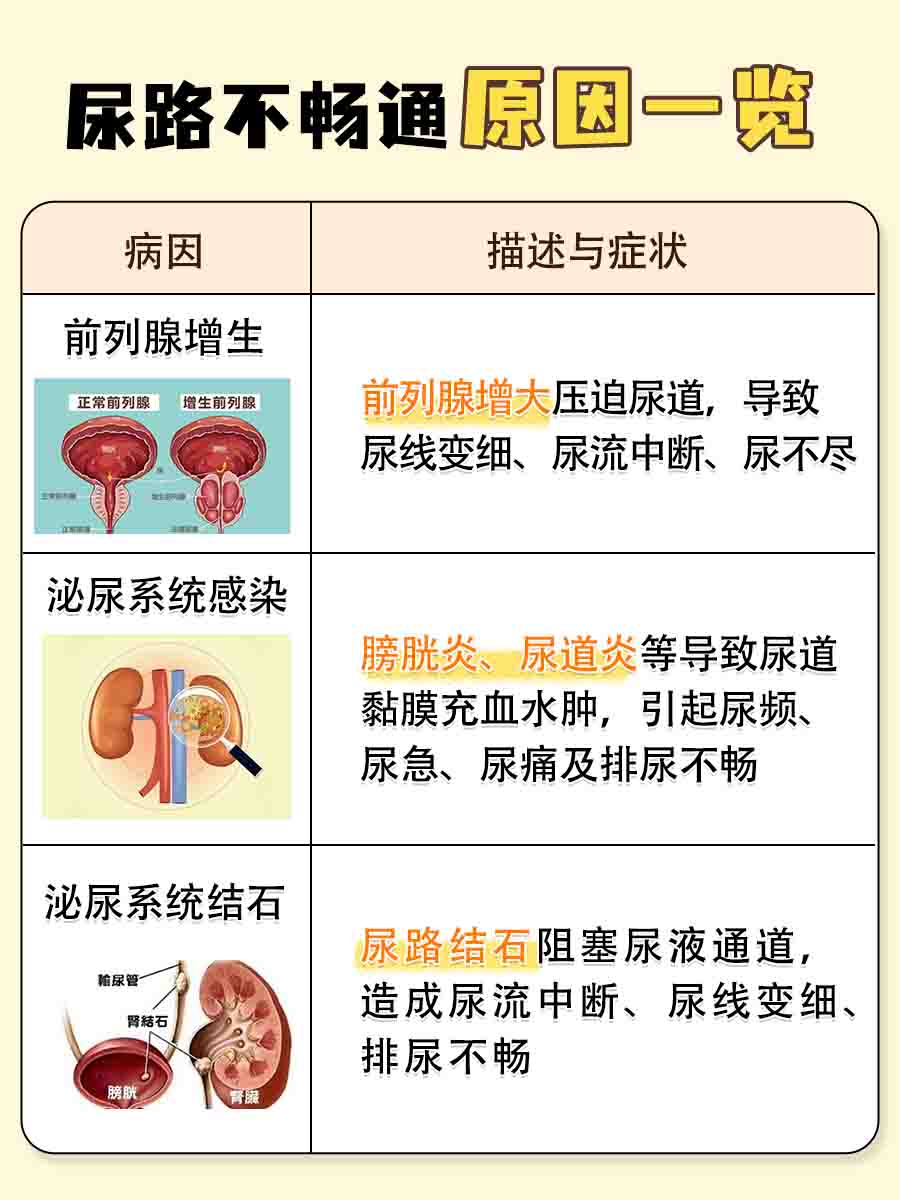揭秘：尿路不畅通的背后原因