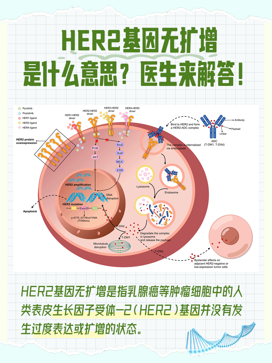 HER2基因无扩增是什么意思？医生来解答！