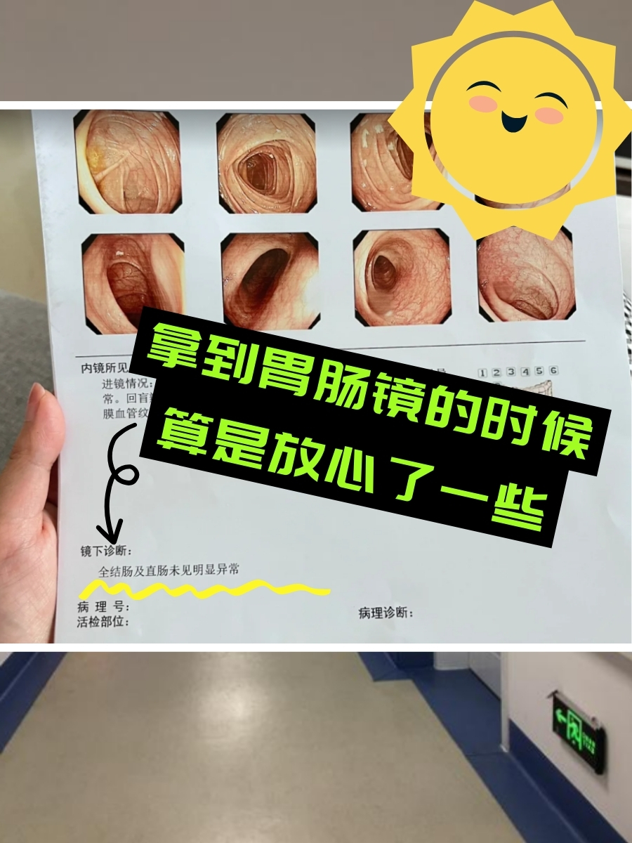 胃肠镜——个人感受分享