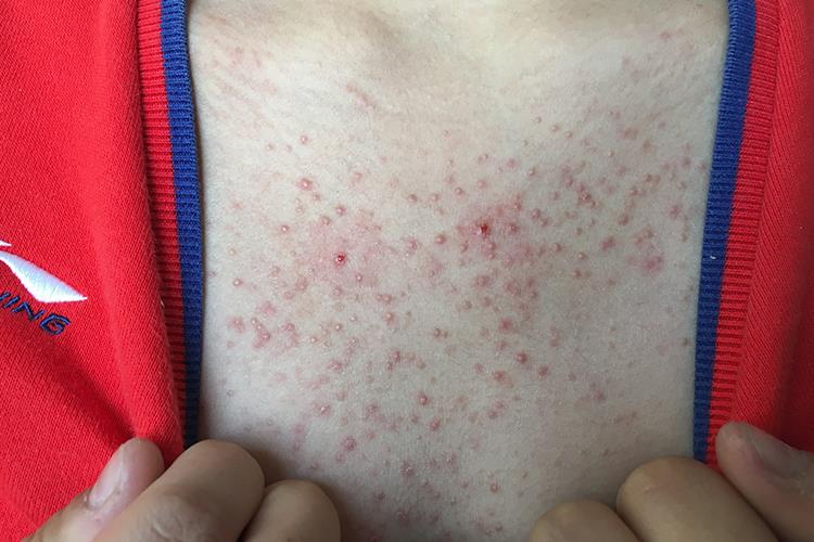 本文由有来医生原创,经专业医师审核校对