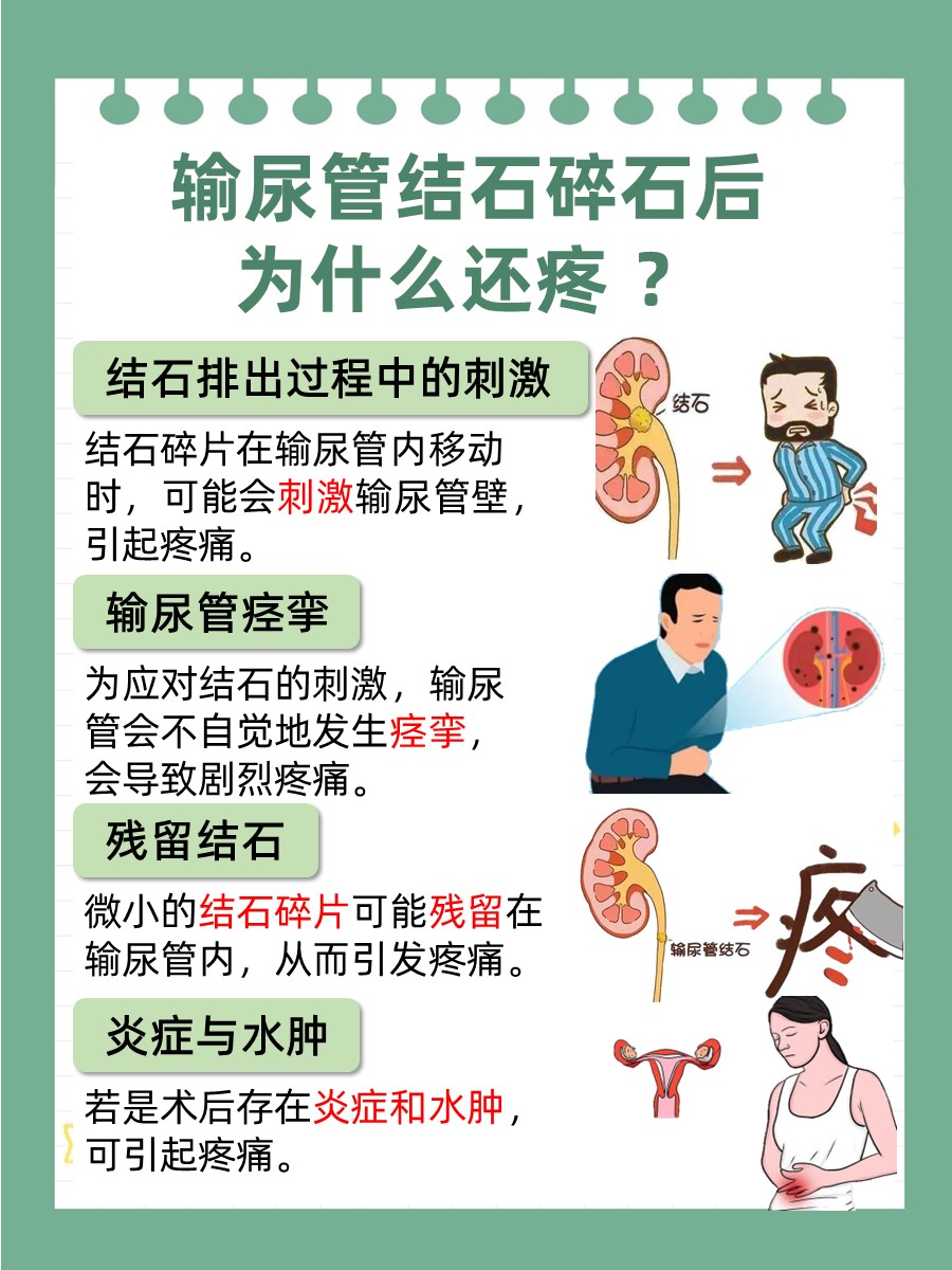 揭秘！输尿管结石碎石后的隐形疼痛源