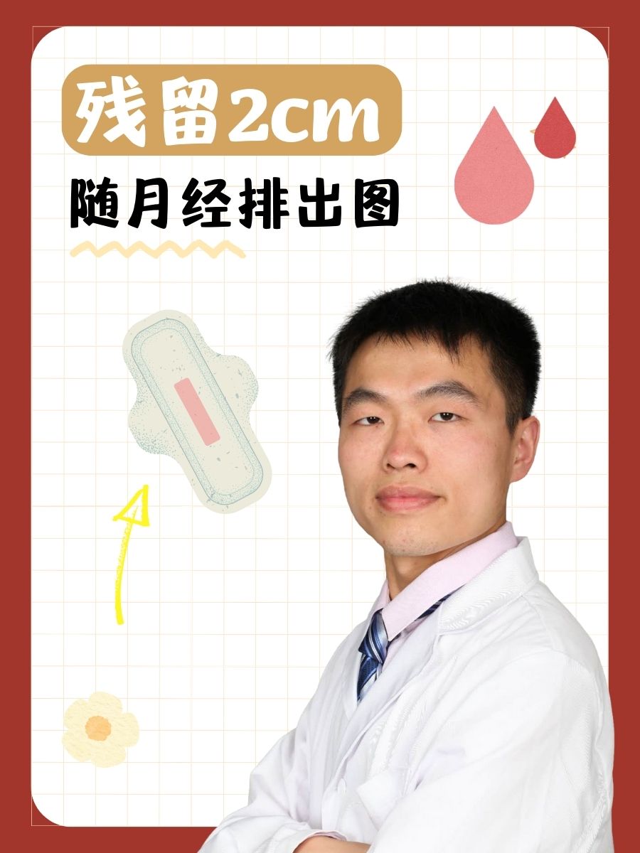 残留2cm随月经排出图