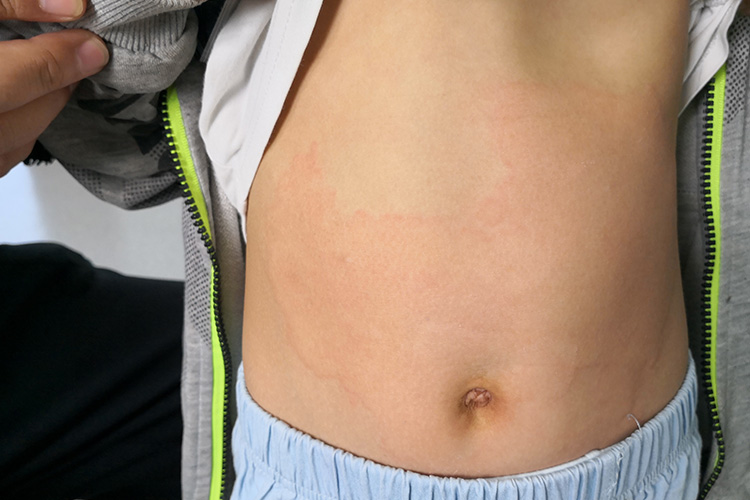 风团融合成片图